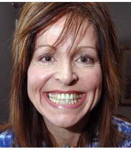 Laughter Yoga - Best Exercise For Body & Mind-img